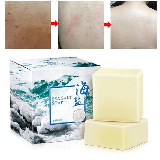 Soap for Acne with Sea Salt