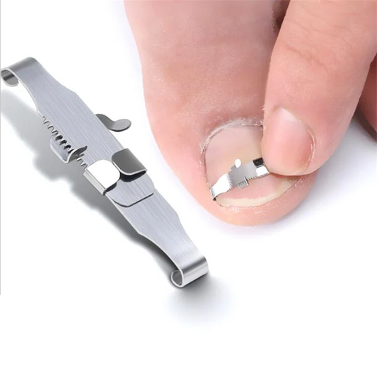 Ingrown Toenail Correction Tool for Foot Care